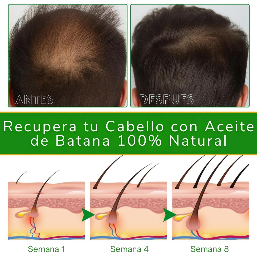 🔥¡¡OFERTA ÚNICA!! - Aceite de Batana + ENVÍO GRATIS🚚