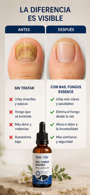 RECUPERA TUS UÑAS - Nails Fungus- Quita Hongos para Uñas + ENVIO GRATIS 🚚