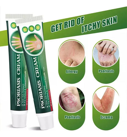 Alivia la Picazón- Crema Antipicazón - ENVIO GRATIS 🚚