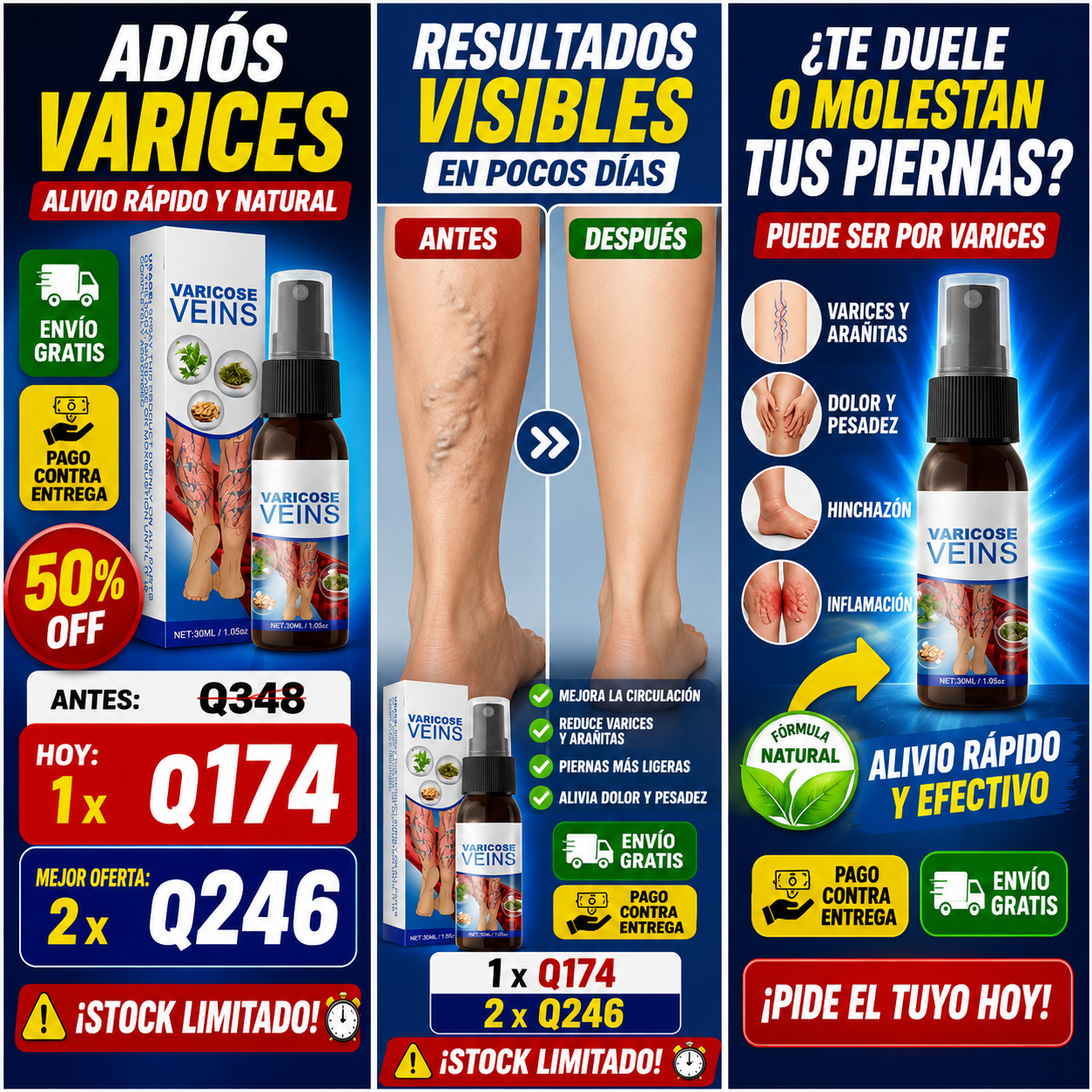 OFERTA LIMITADA - Spray para Varices Salud en tus Piernas + ENVIO GRATIS 🚚