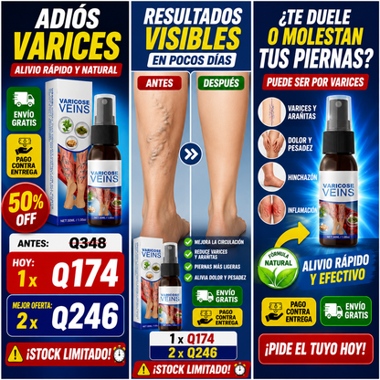 OFERTA LIMITADA - Spray para Varices Salud en tus Piernas + ENVIO GRATIS 🚚