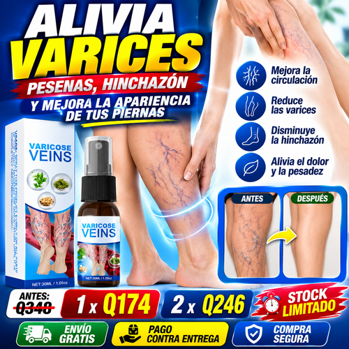 OFERTA LIMITADA - Spray para Varices Salud en tus Piernas + ENVIO GRATIS 🚚