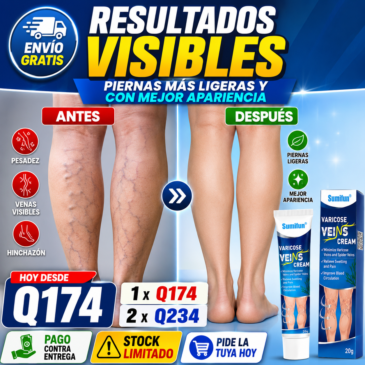 OFERTA IMPERDIBLE - Crema para Varices Piernas Lindas + ENVIO GRATIS 🚚