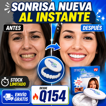 APROVECHA LA OFERTA - Carillas Dentales + ENVIO GRATIS 🚚