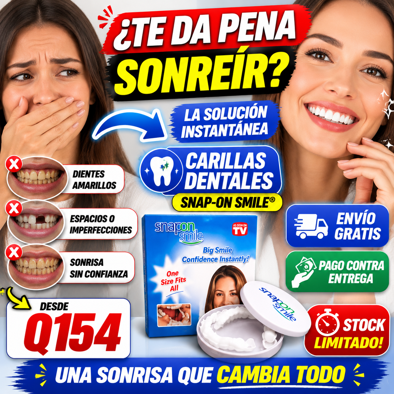 APROVECHA LA OFERTA - Carillas Dentales + ENVIO GRATIS 🚚